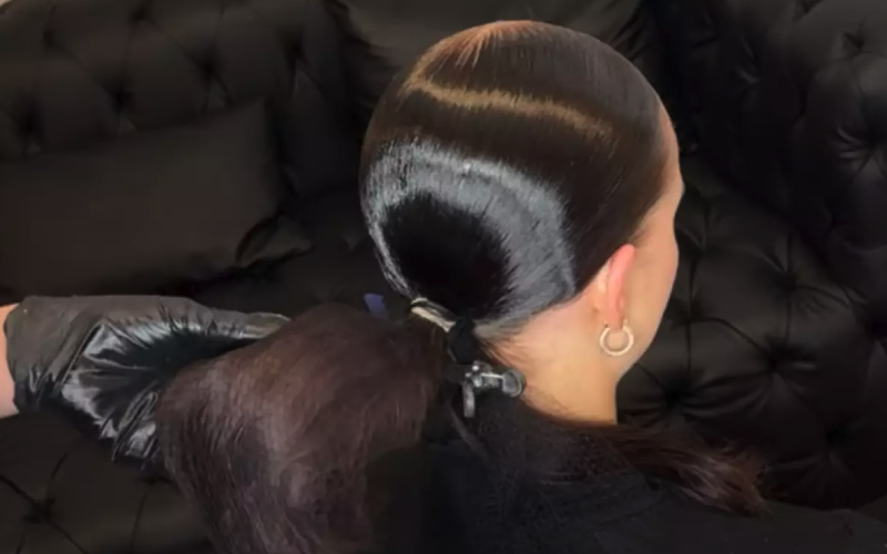 O penteado viral da internet pode estar acelerando a sua calvicie