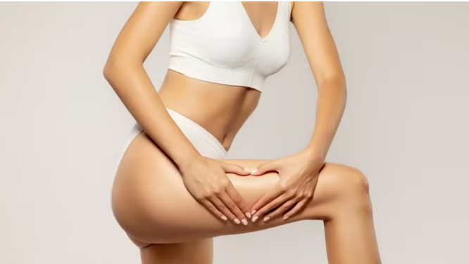 Cirurgia plástica pode piorar a celulite? Médica explica o efeito colateral pouco discutido