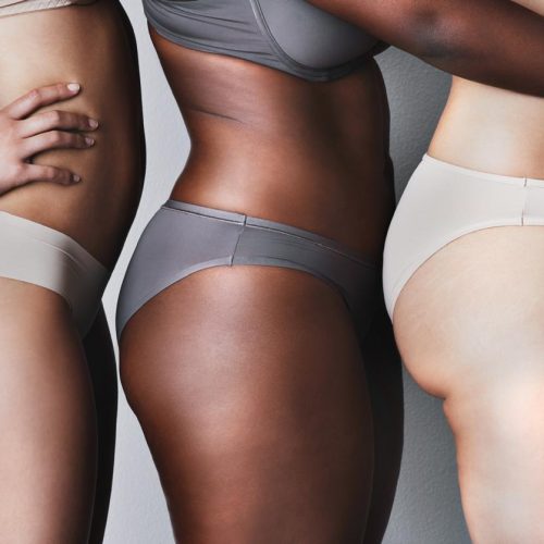 Dia do Combate à Celulite reforça que o problema vai além da estética e afeta a saúde e autoestima de milhões de mulheres