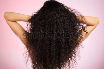 Transplante capilar na população trans: quando a medicina ajuda a afirmar identidade e autoestima