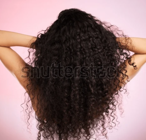 Transplante capilar na população trans: quando a medicina ajuda a afirmar identidade e autoestima