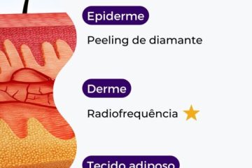 A combinação ideal: Radiofrequência e Ultrassom unidos em tratamentos estéticos