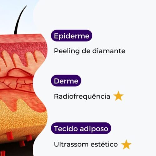 A combinação ideal: Radiofrequência e Ultrassom unidos em tratamentos estéticos