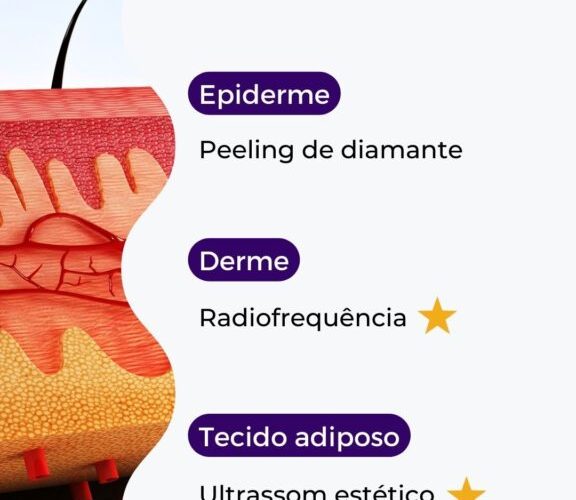 A combinação ideal: Radiofrequência e Ultrassom unidos em tratamentos estéticos