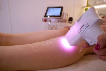 Laser de Epilação: A Nova Alternativa Eficiente Contra os Métodos Convencionais de Depilação