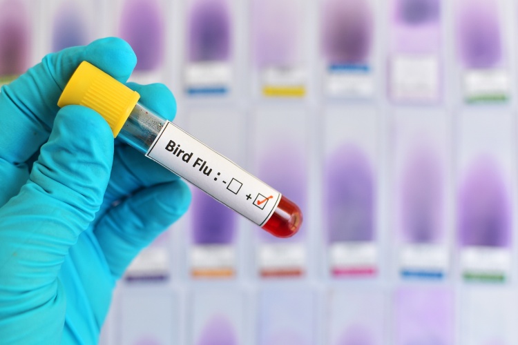 Situação da gripe aviária no Brasil e dicas para evitar a contaminação