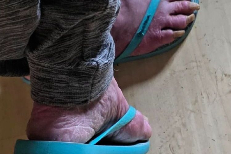 Rejane Schumann, a ex-atriz que contracenou com Glória Pires, resgatada em situação de vulnerabilidade sem alimentos